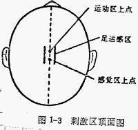 思維穴|醫砭 » 中華針灸 » 方云鵬頭針穴名體系